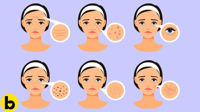 7 Foods That Are Toxic For Your Skin