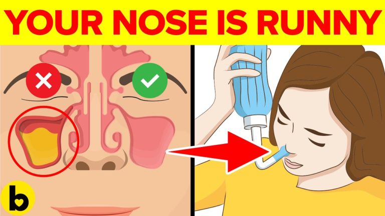 9 Reasons Why Your Nose Keeps Running