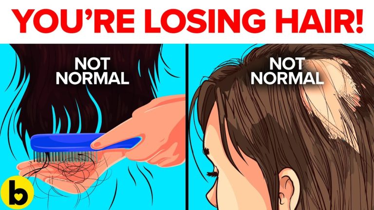 7 Ways To Tell If You’re Losing Too Much Hair