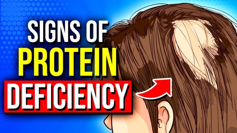7 Warning Signs You’re Not Eating Enough Protein!