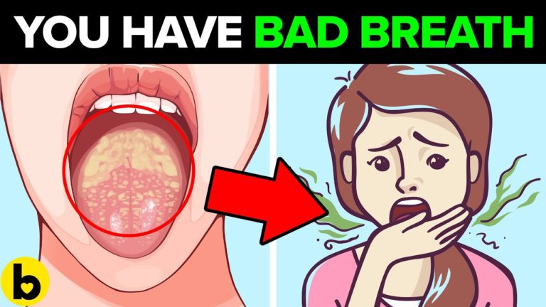 9 Causes Of Bad Breath And How To Fix It