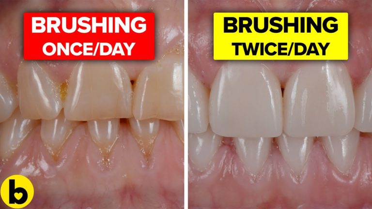 18 Foods And Habits That Are Staining Your Teeth