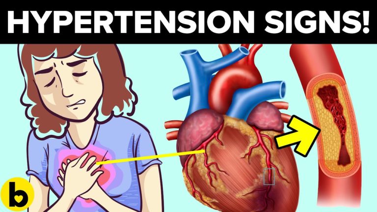 10 Hidden Signs Of Hypertension You CANNOT Ignore