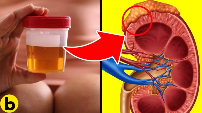 This Is What Your Urine Can Tell You About Your Health