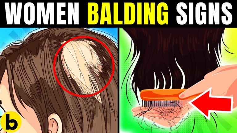 4 Major Warning Signs Of Balding In Women