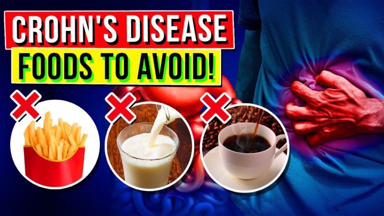 9 Foods To Avoid If You Have Crohn’s Disease
