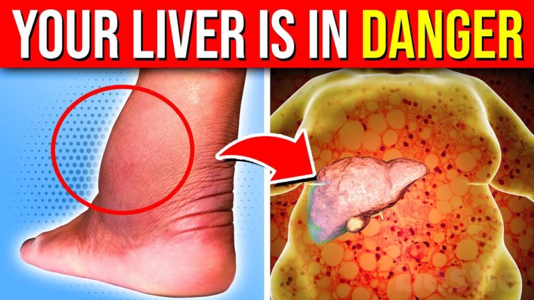 11 ALARMING Signs Of Liver Damage Your Body Is Warning You About