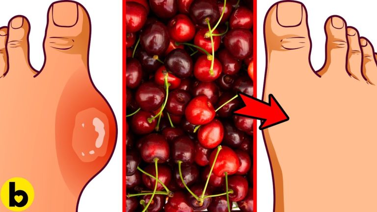 7 POWERFUL Reasons Of Eating Cherries Every Day